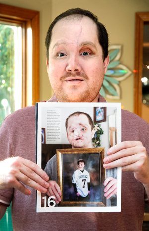 Derek Pfaff displays a page from the March/April, 2021 edition of FAITH Magazine (now called Great Lakes Bay Catholic Magazine) of the Diocese of Saginaw, Mich., that shows a photo of him holding a portrait of himself in high school wearing his Harbor Beach High School football jersey at his family home in Harbor Beach, Mich., Oct. 19, 2019. In March 2014, Derek tried to take his life by shooting himself in the face with his shotgun. In February 2024, Derek received a rare face transplant at the Mayo Clinic in Rochester, Minn.